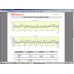 Surftest SJ-412 [mm] 178-582-31D